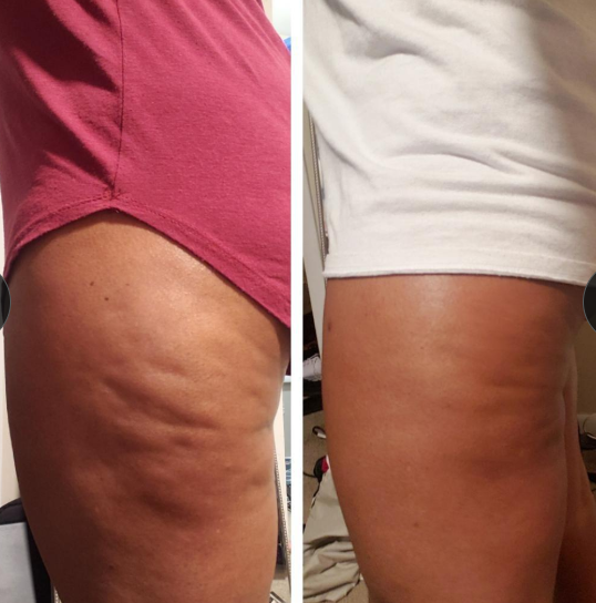 Confianza Natural 7 en 1™