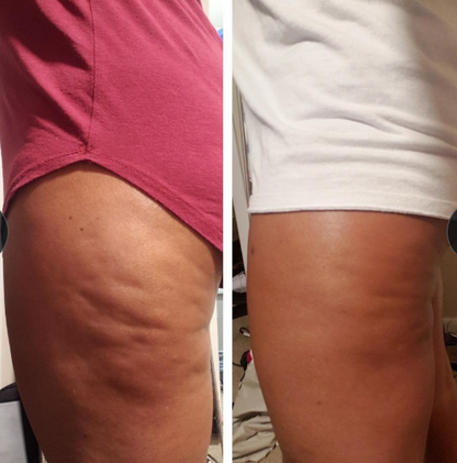 Confianza Natural 7 en 1™